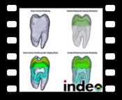 Tooth - Indeo: comparison of Context-Preserving Volume Rendering with other techniques